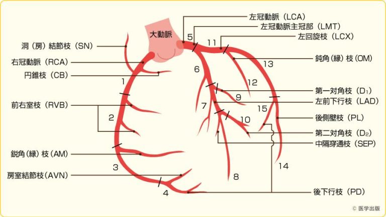 CADを自然に予防する方法